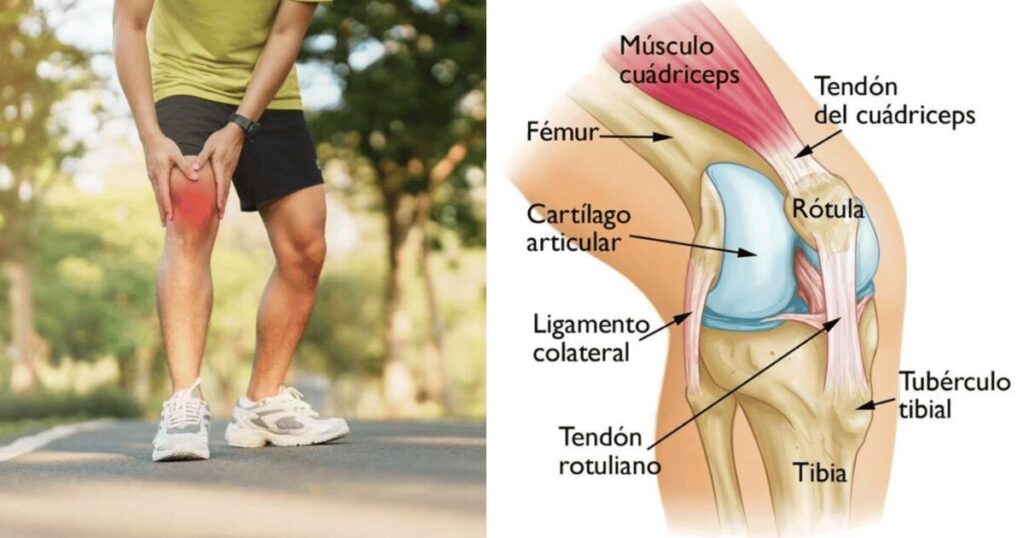 Dolor rodilla, rodilla corredor, tendinitis, tendinopatia